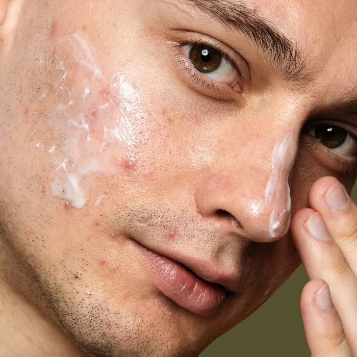 Rutina pentru ten gras/mixt - imagine 2