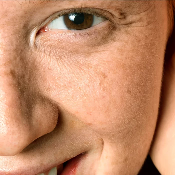 Rutina pentru ten uscat/normal - imagine 2