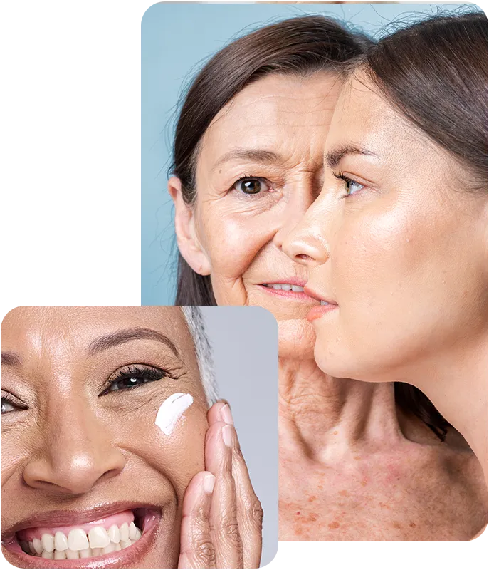 tratament riduri Remivia Cosmetics