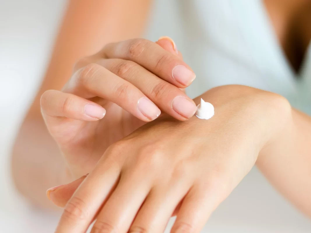 Scapa-de-urmele-acneei