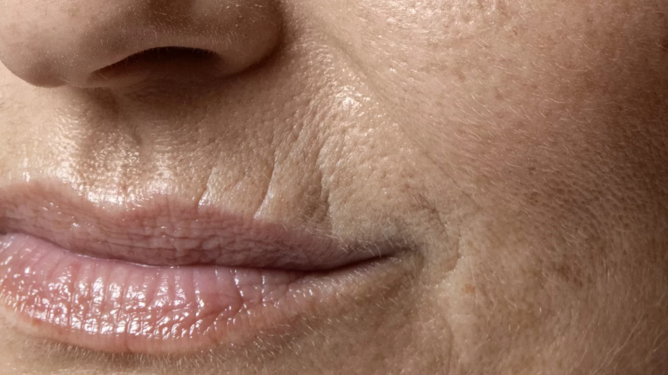 Care Este Diferența Dintre Linii Fine Și Riduri? close up face pores texture