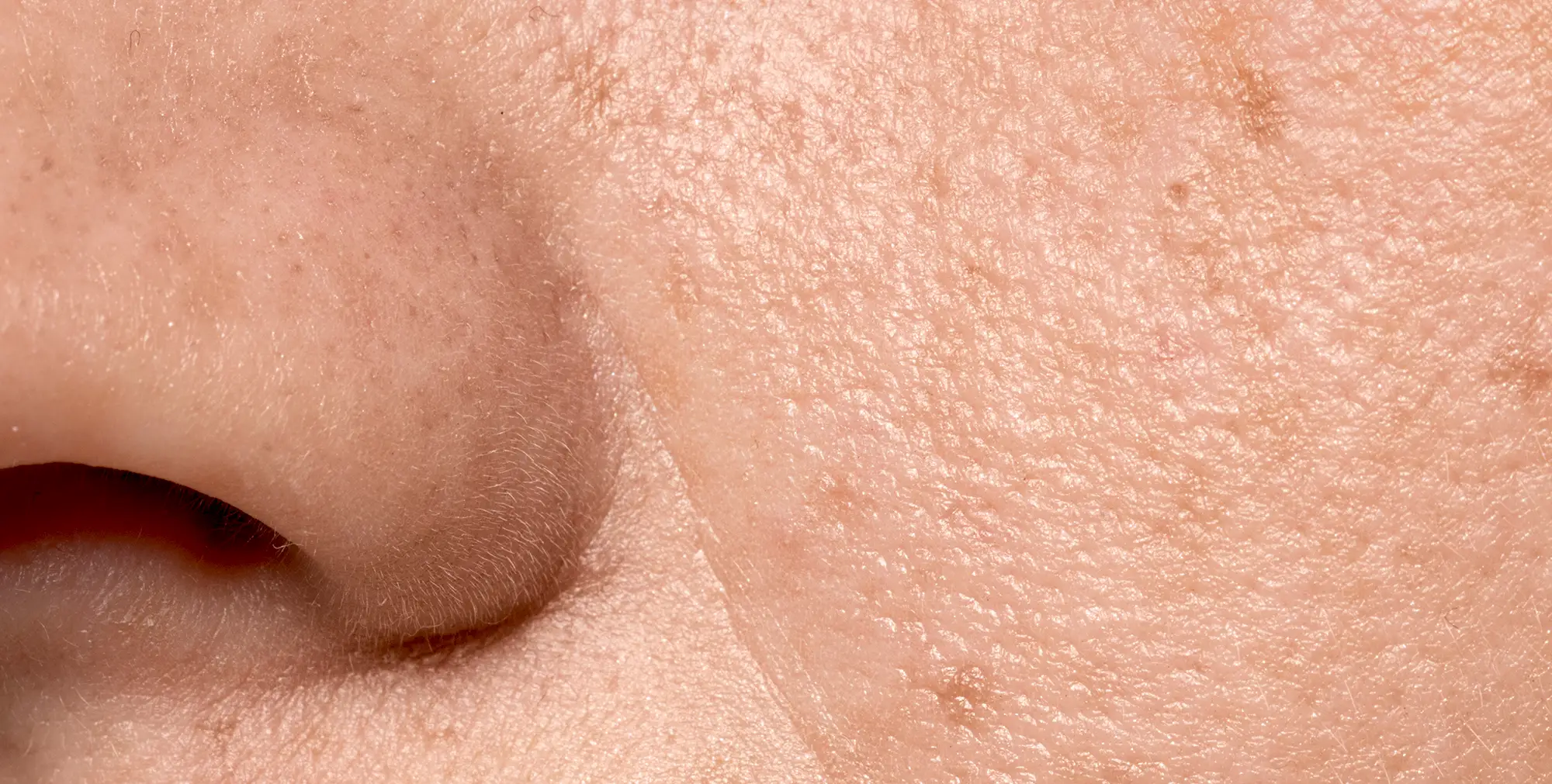 Acid salicilic tratament puncte negre