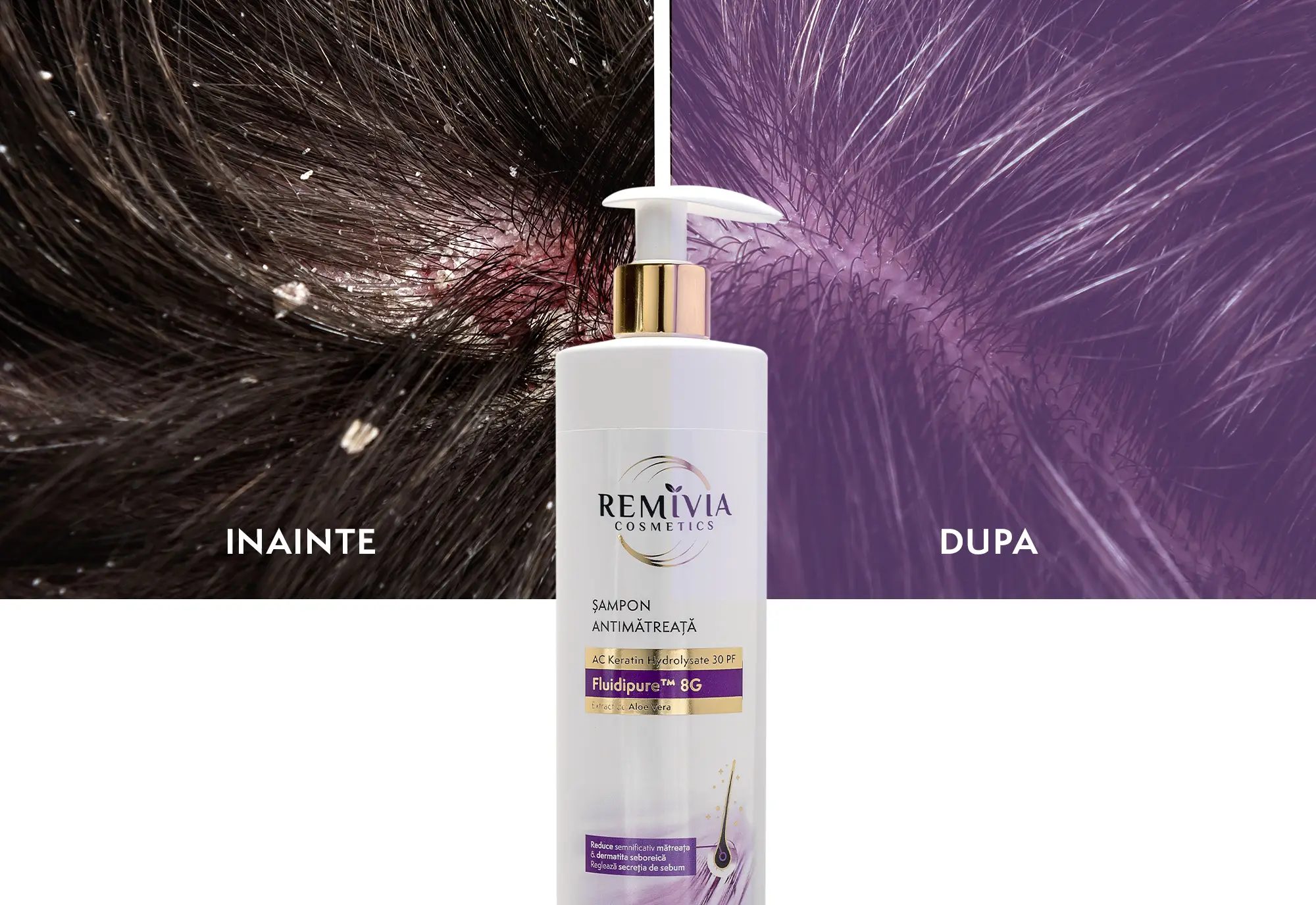sampon matreata si dermatita seboreica scalp Remivia Cosmetics