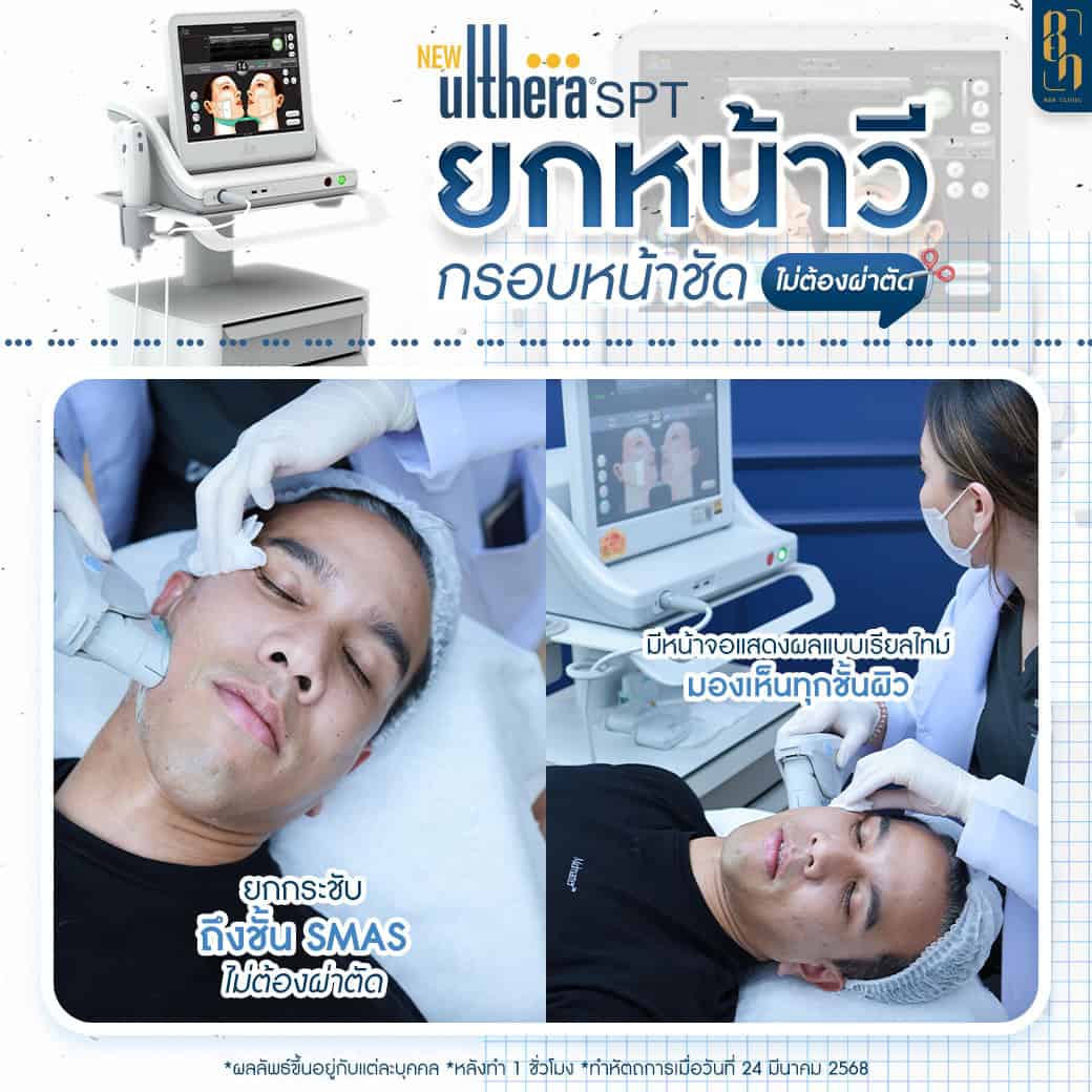 Ulthera คือ