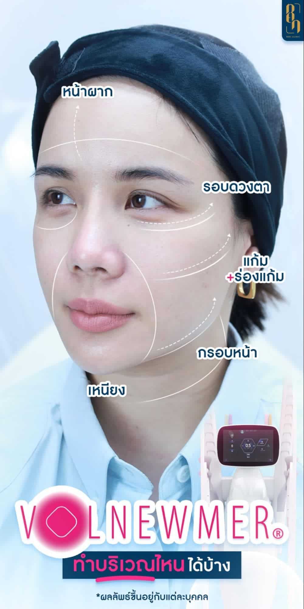 RF ทำตำแหน่งไหนได้บ้าง