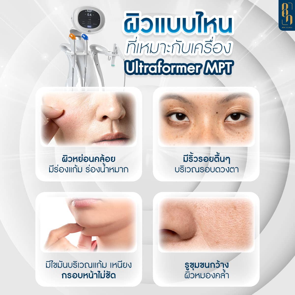 Ultraformer MPT เหมาะกับใคร