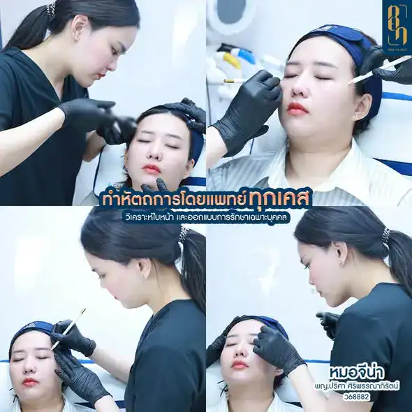 การฉีดฟิลเลอร์