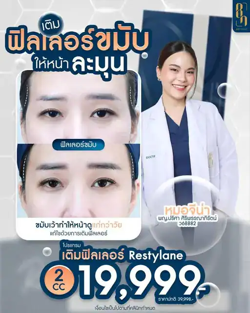 รีวิวฟิลเลอร์5
