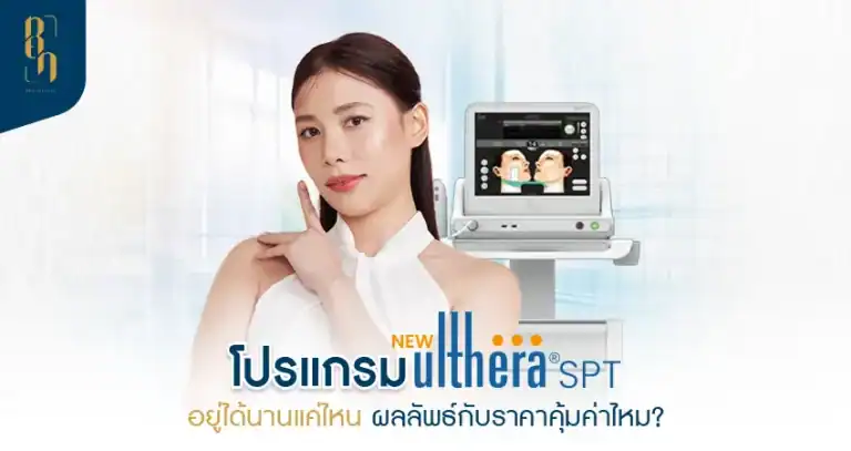Ulthera อยู่ได้นานแค่ไหน