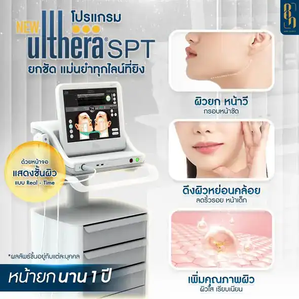 Ulthera อยู่ได้นานแค่ไหน ต้องทำซ้ำกี่ครั้ง