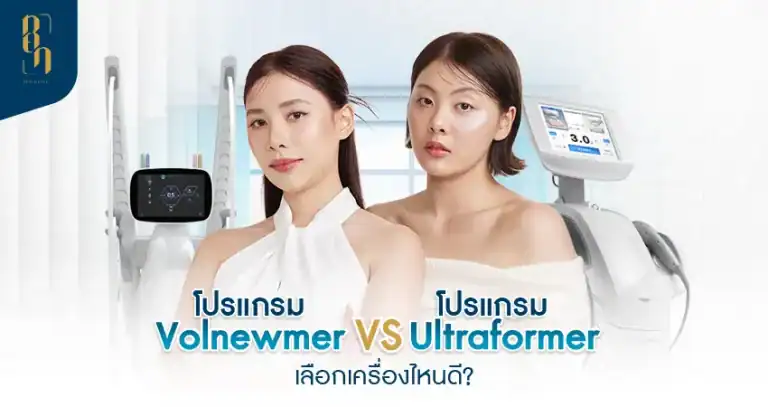 Volnewmer VS. Ultraformer