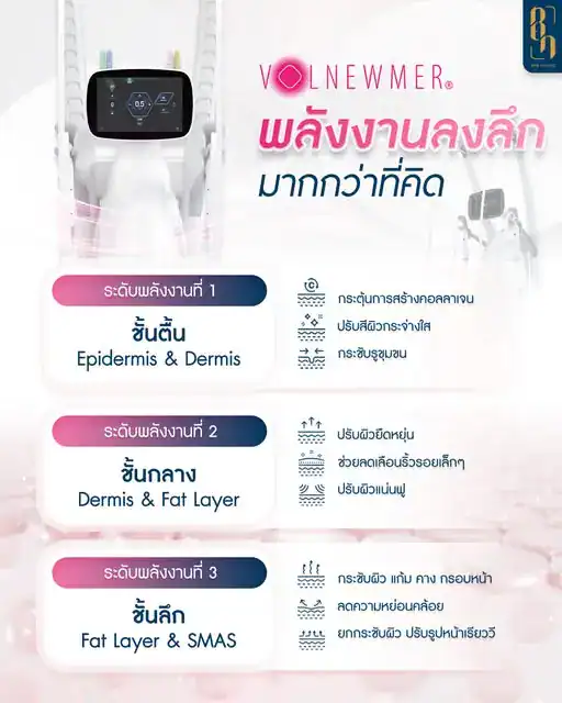 โปรแกรม Volnewmer คืออะไร?