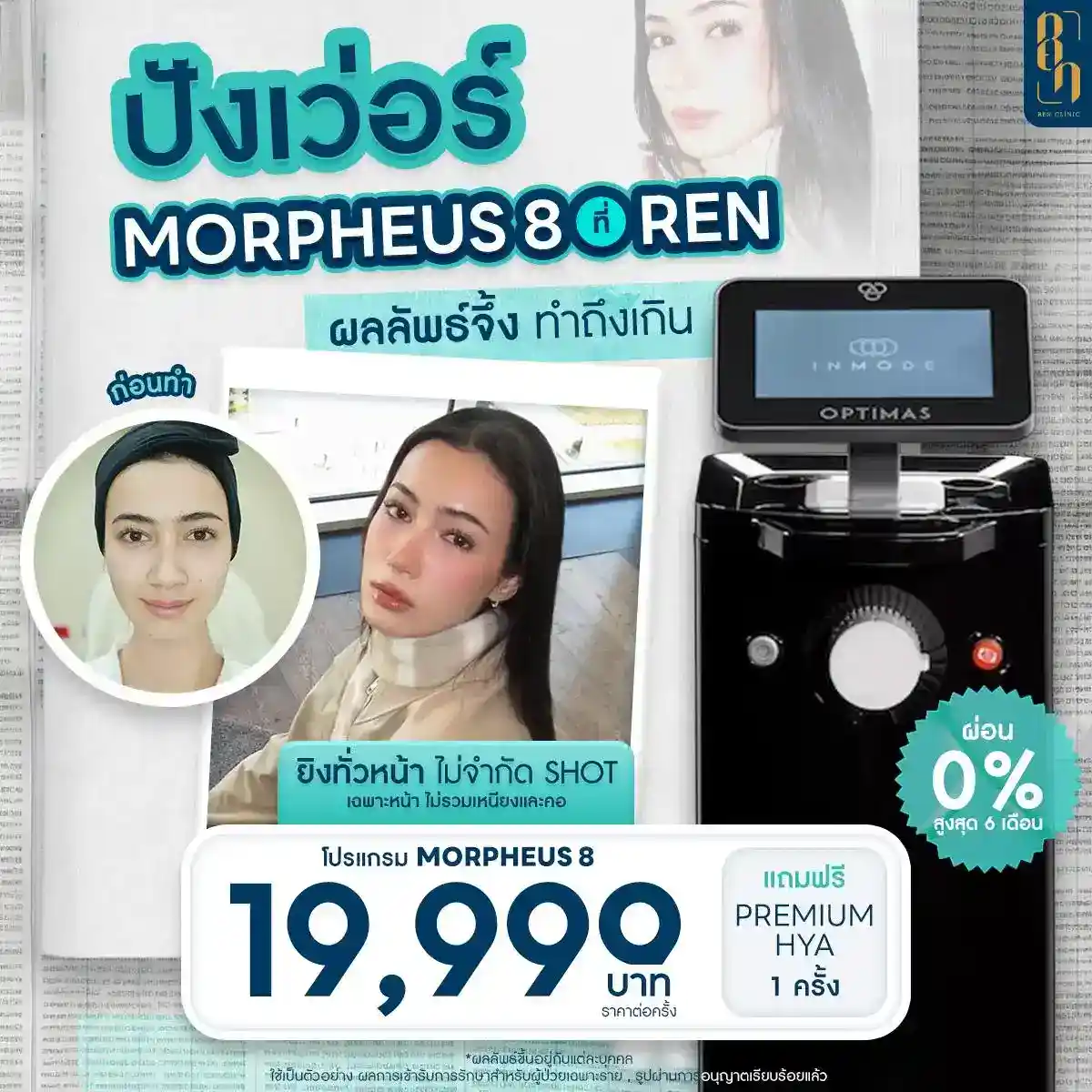 morpheus8 ราคาโปรโมชั่น