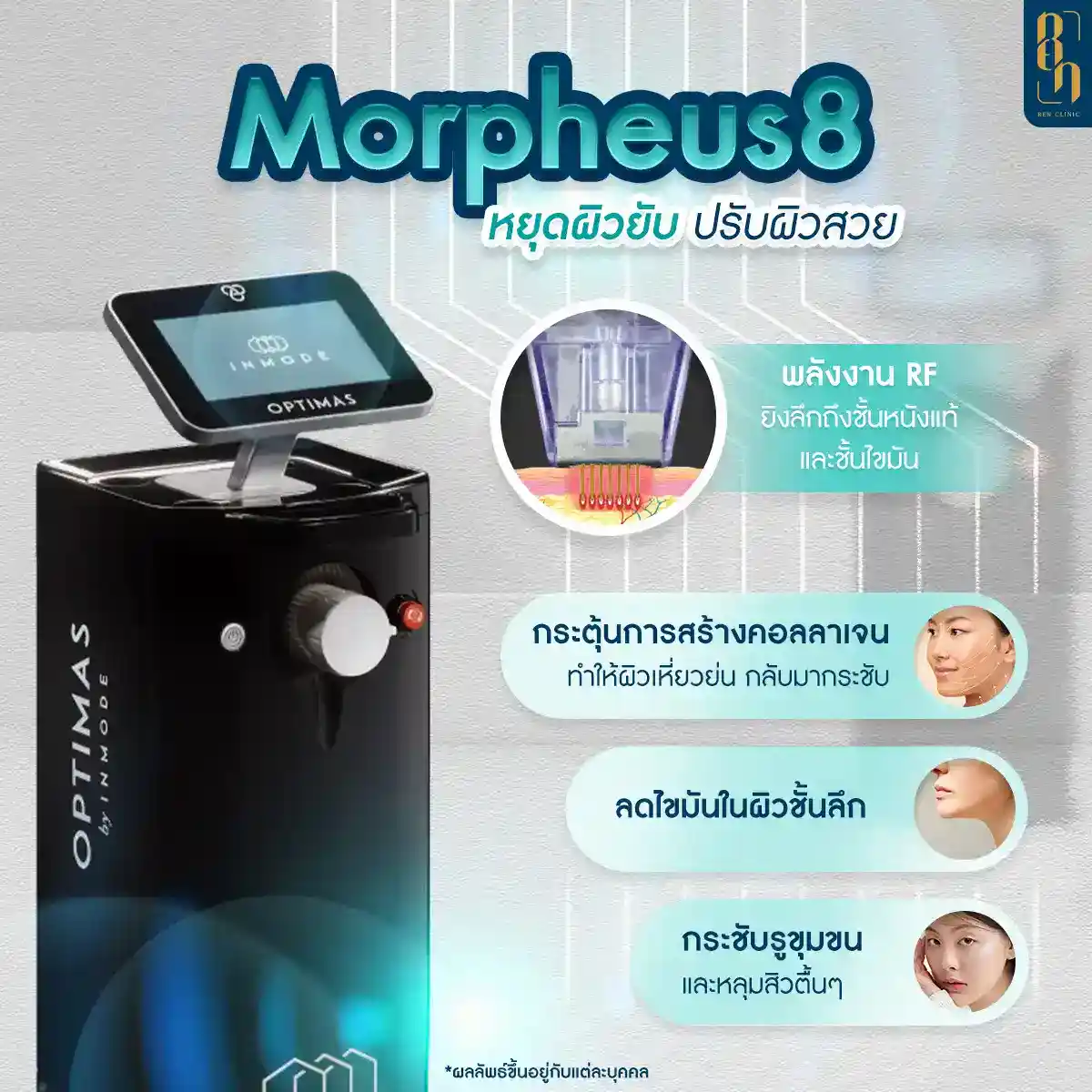 ราคา morpheus8