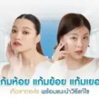 แก้มห้อย แก้มย้อย แก้มเยอะ เกิดจากอะไร พร้อมแนะนำวิธีแก้ไข