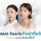 SMAS คืออะไร ทำหน้าที่อะไร ทำไมต้องยกกระชับผิวที่ชั้นนี้