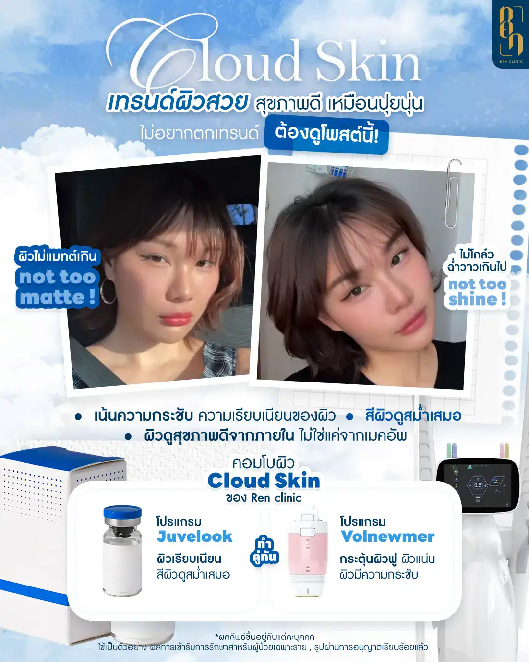 วิธีกระชับรูขุมขน เร่งด่วน