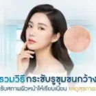 วิธีกระชับรูขุมขนกว้าง ปรับสภาพผิวหน้าให้เรียบเนียน แลดูสุขภาพดี