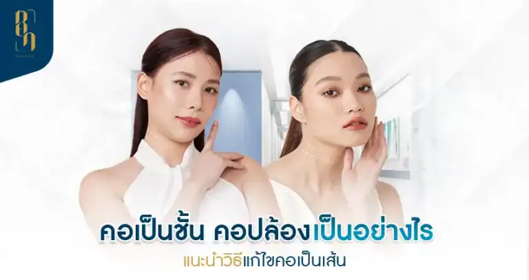 คอเป็นชั้น
