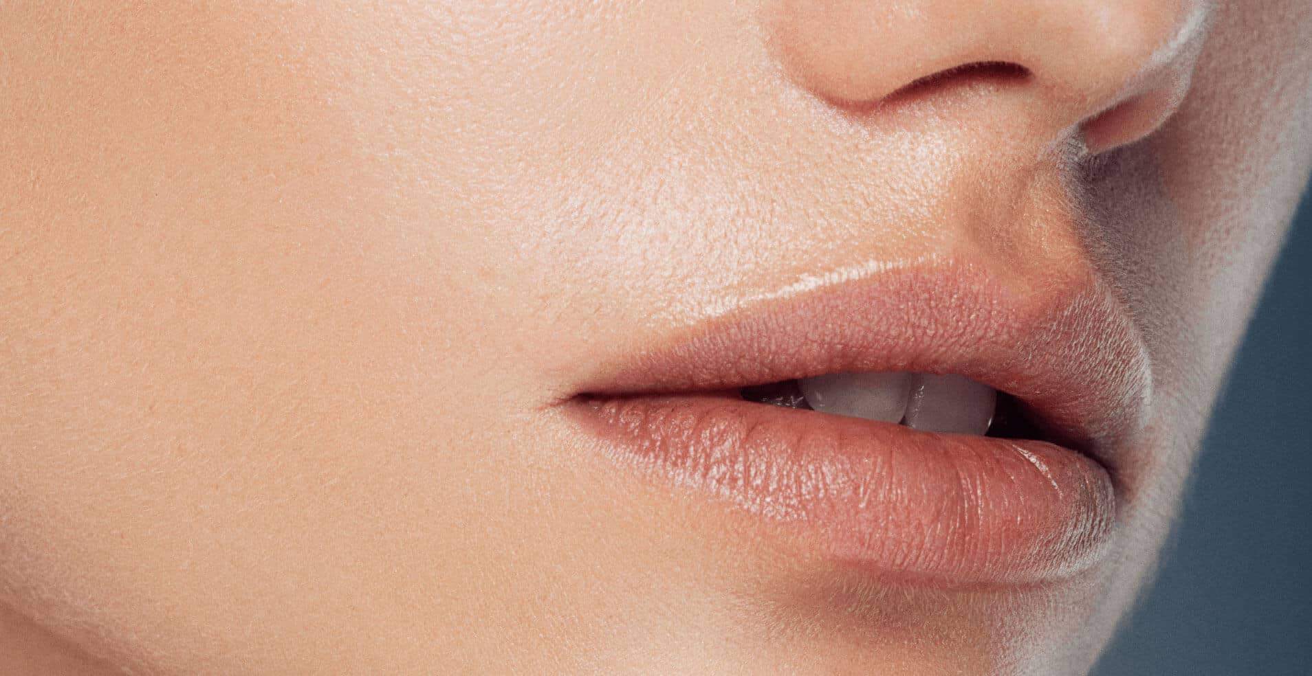 Lip-fillers
