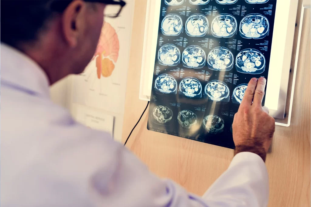 Stem Cell Therapy for Neurological Disorders