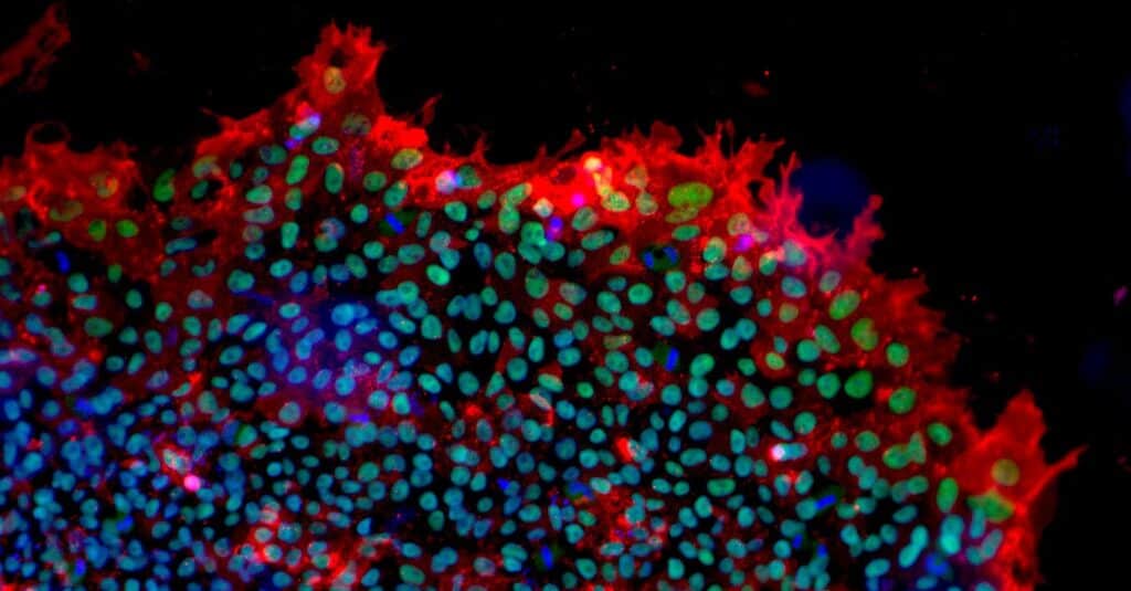 Pluripotent stem cells in tijuana mexico