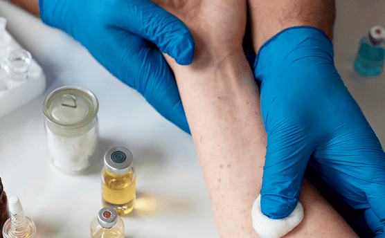 doctor checking person s skin allergy 1 1