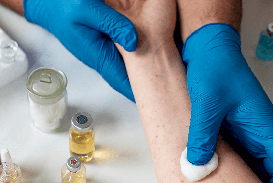 doctor checking person s skin allergy 1