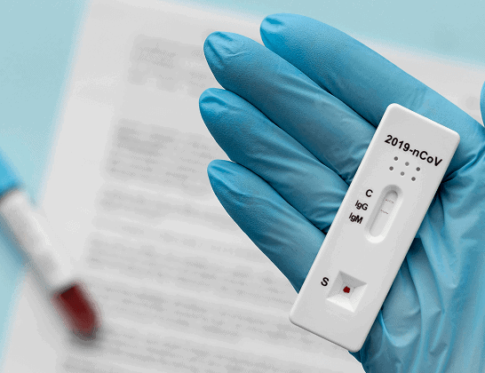 hand with protective gloves holding covid test 1 1