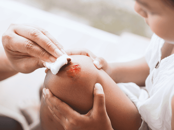 parent helping her child perform first aid knee injury after she has been accident 1