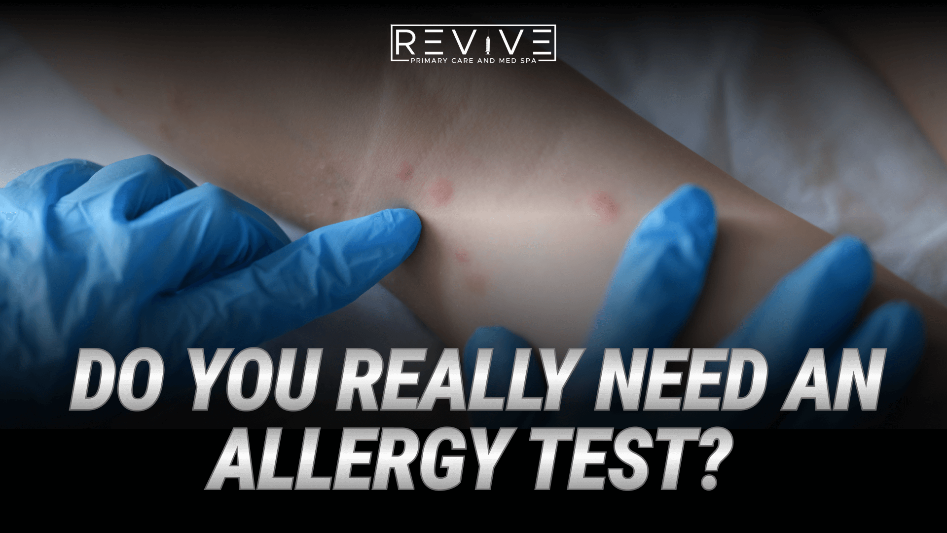 Allergy Testing v1 1