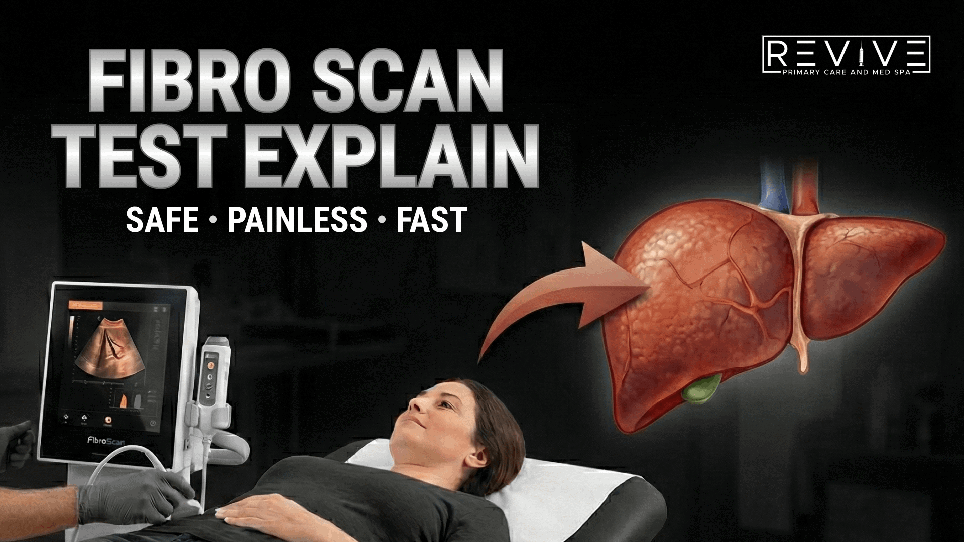 FibroScan v2 1 1
