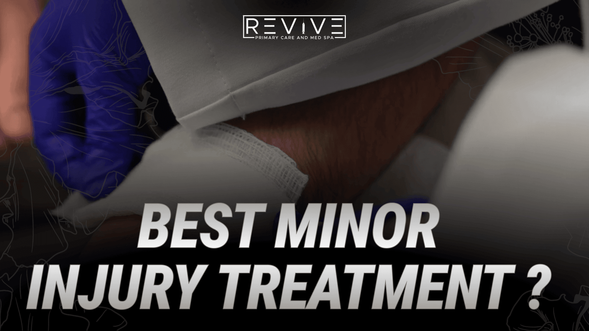 Revive NOV13 Minor Injuries v2 1