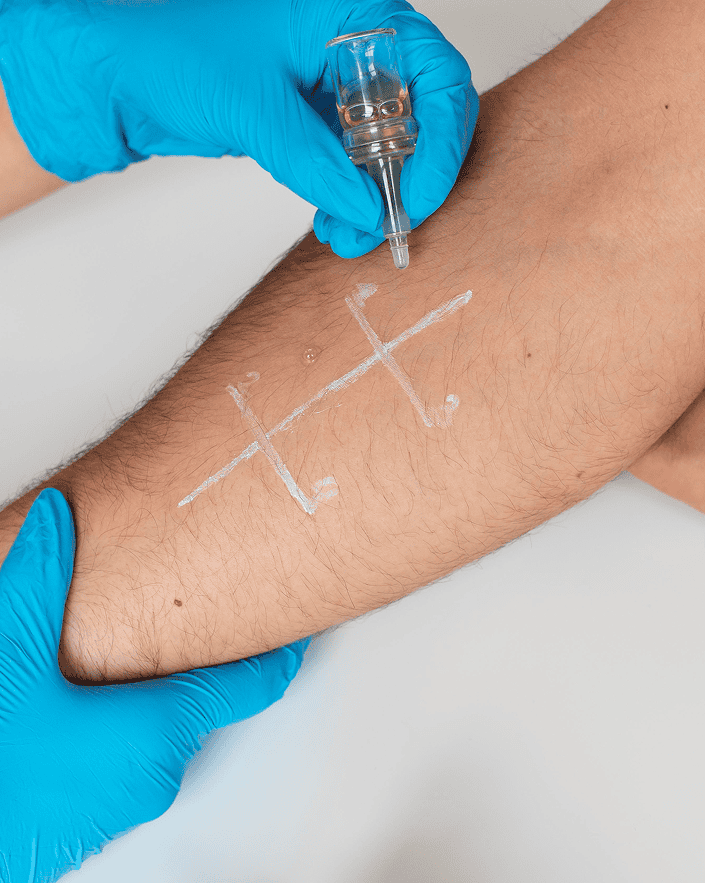 hlebologist examines patient with varicose veins his leg 1