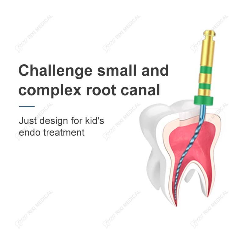 微创儿童根管治疗工具示意图，适用于复杂和微小根管的内科治疗方案.