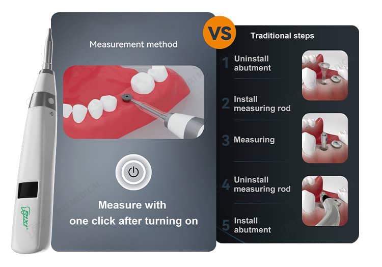 dental implant stability meter detail image 2