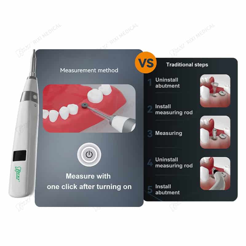 Digital Dental Implant Stability Meter for Osseointegration Analysis main image 7