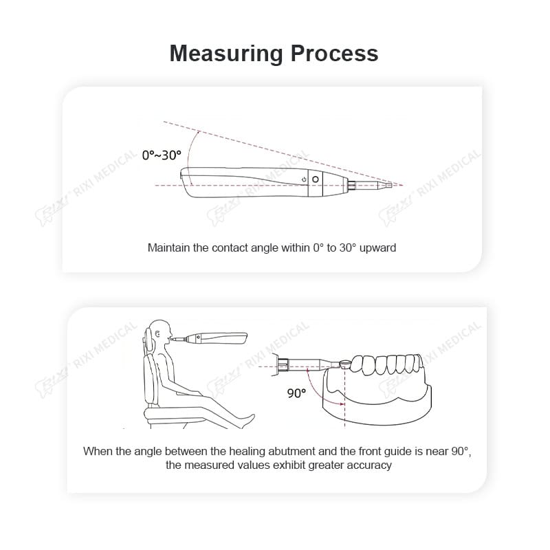 Digital Dental Implant Stability Meter for Osseointegration Analysis main image 8