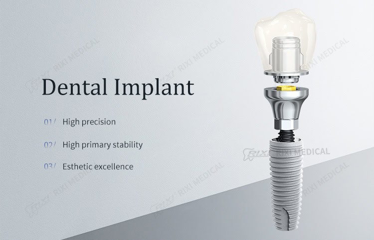 titanium dental implant fixture detail image 1