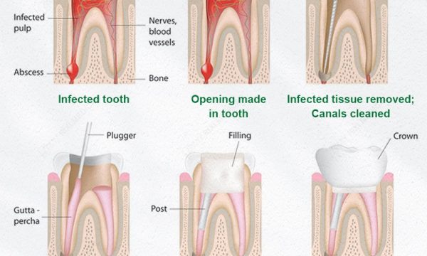 Best Dental Chair Brands — CE/FDA Certified by Rixi Medical
