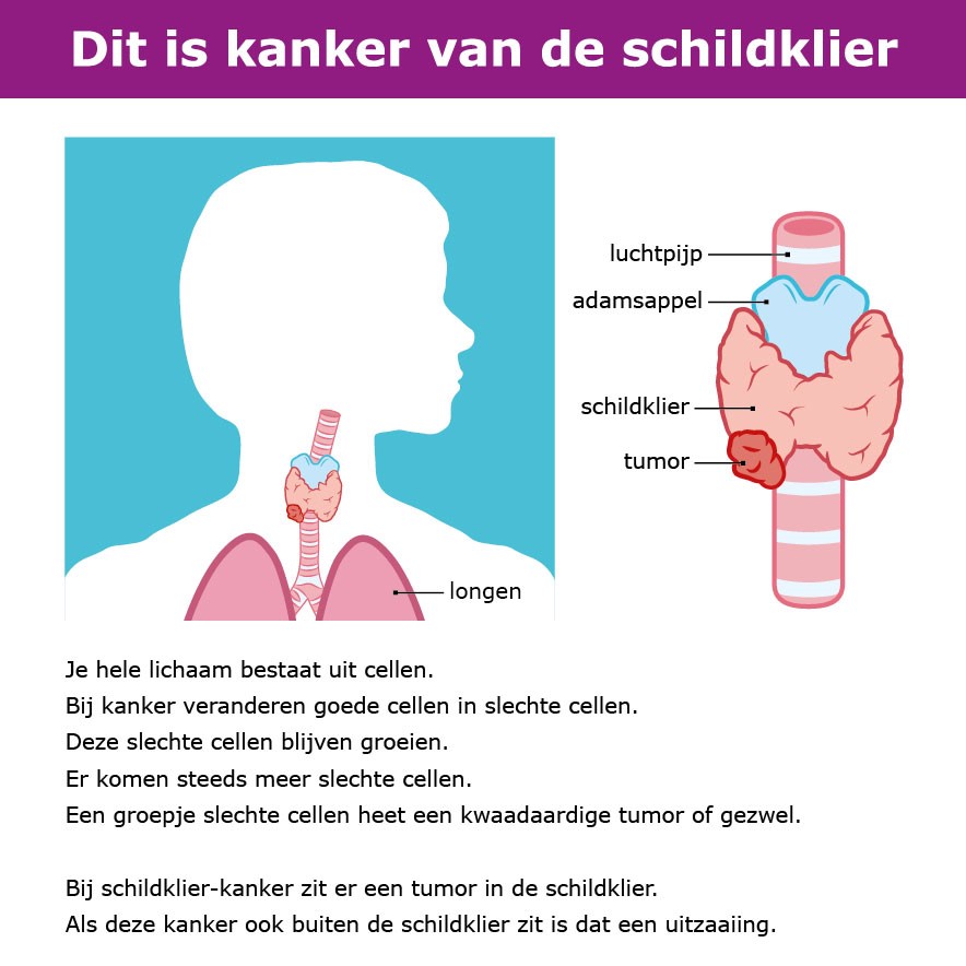 Praatkaart schildklierkanker