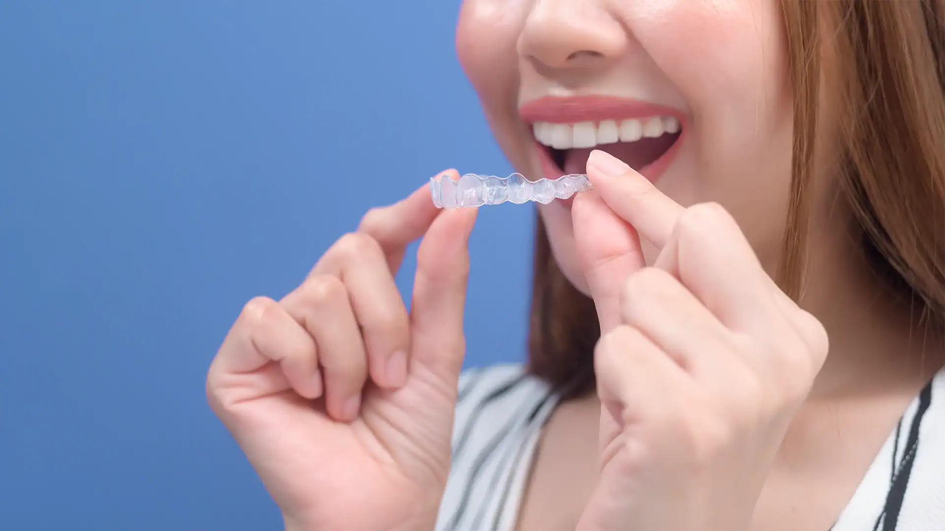 Invisibility & Comfort: The Clear Invisalign Benefits