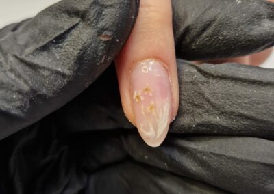 Naturnagelverstärkung für gesunde und starke Nägel