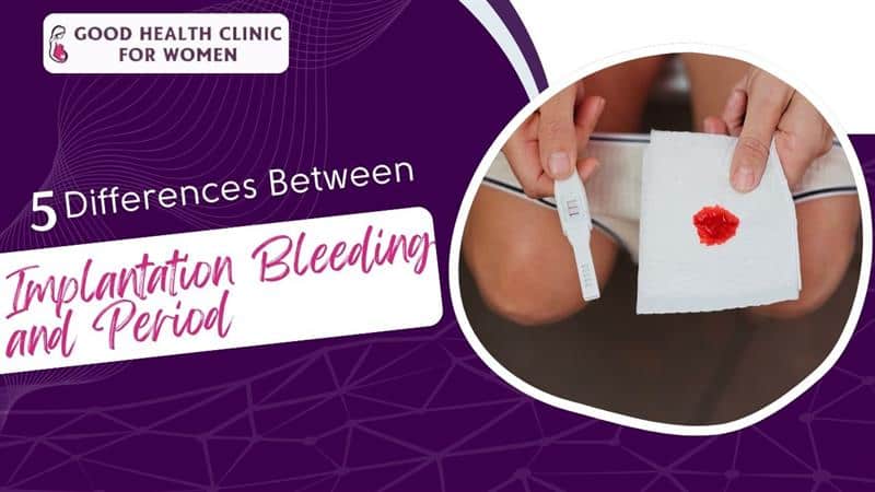 Implantation bleeding versus period