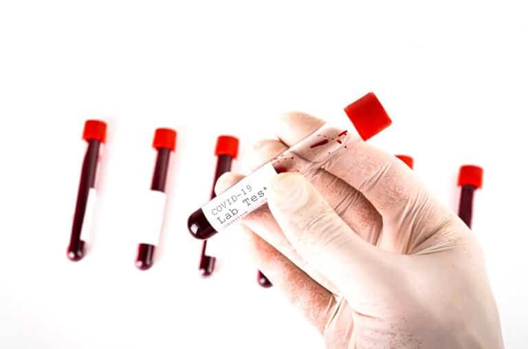 Hand holds a test tube containing a blood sample, test tube for Covid-19 (coronavirus) analyzing. Laboratory testing patient’s sample