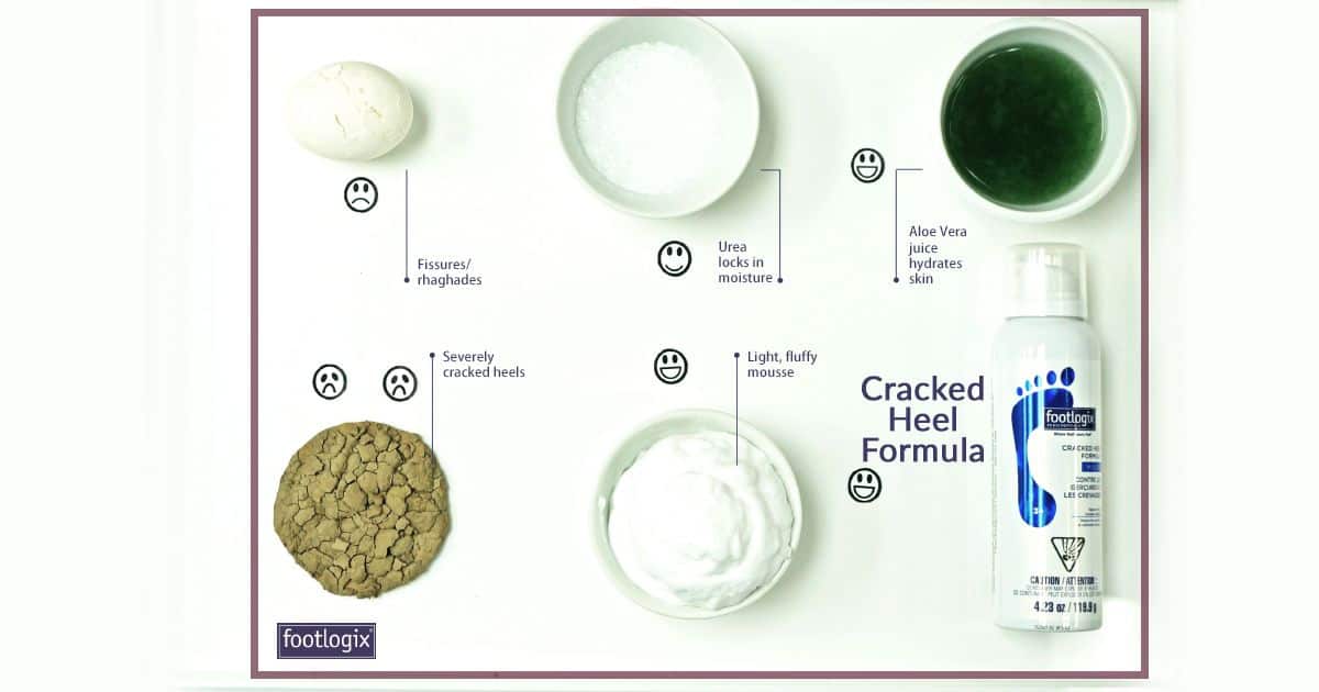 Footlogix Cracked Heel Formula with aloe vera and hydrating ingredients for dry, severely cracked he.