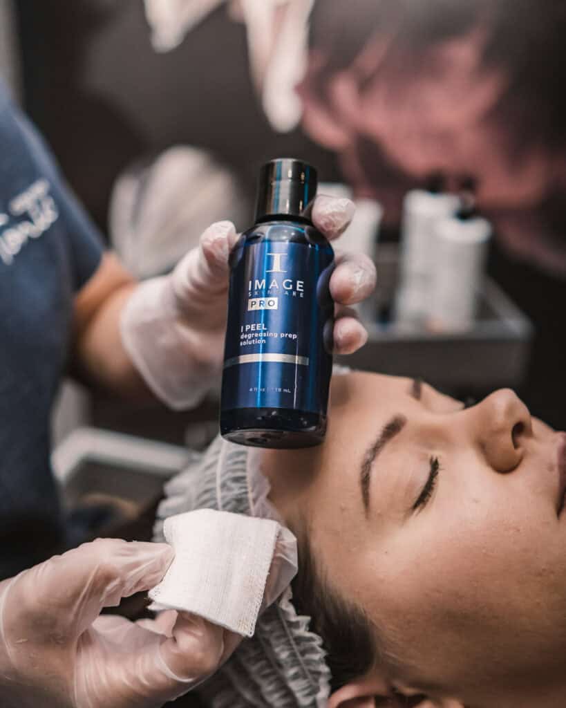 Chemical peel being applied for skin rejuvenation and improved complexion.