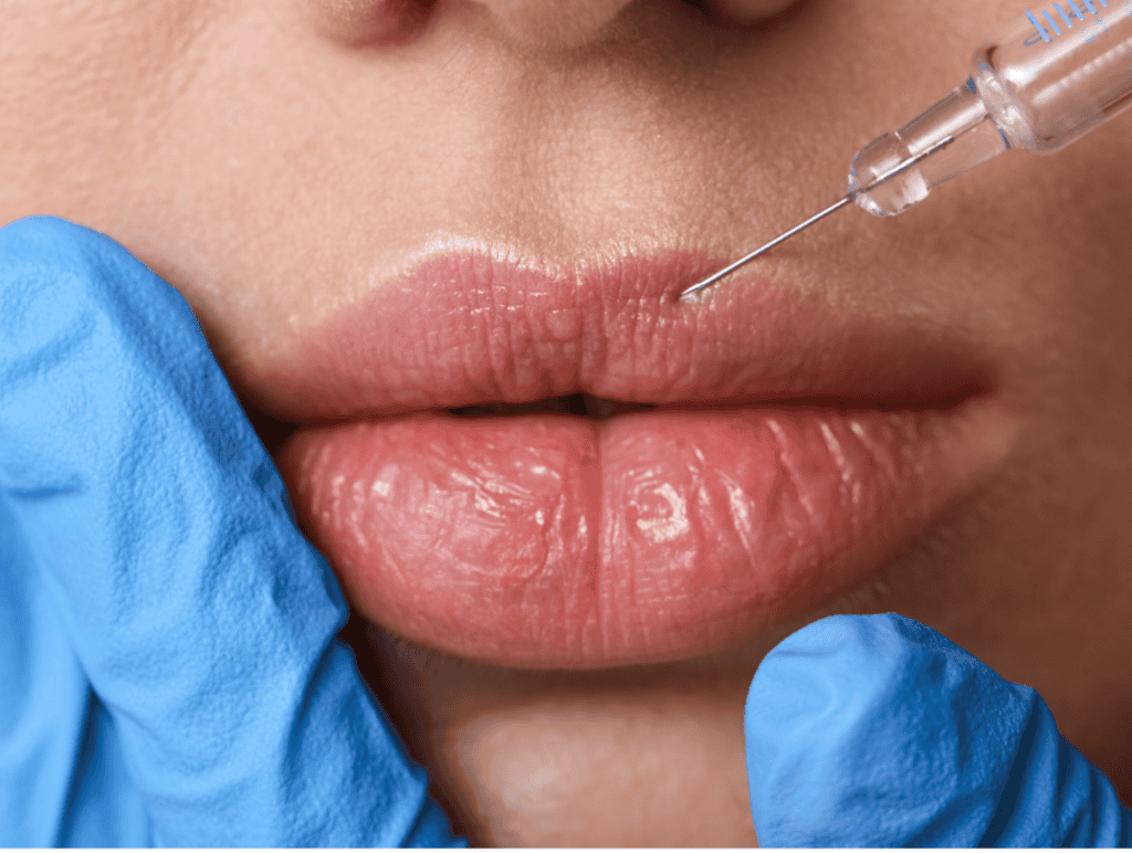 Lip enhancement injection procedure at Tonic Day Spa, focusing on aesthetic treatments.