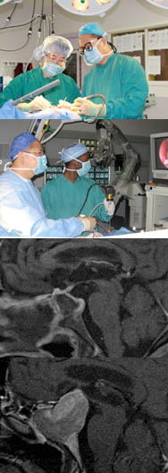 tumor Brain Tumor Program