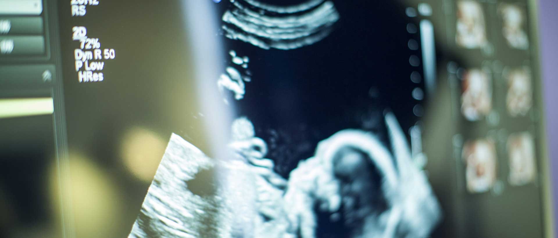 Valley Ultrasound